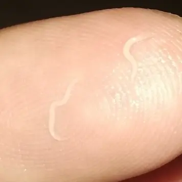 What threadworms look like